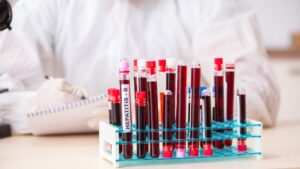 Leia mais sobre o artigo Hematologista: o que faz, quando procurar e como é a consulta com o Dr. Paulo Ganacini?