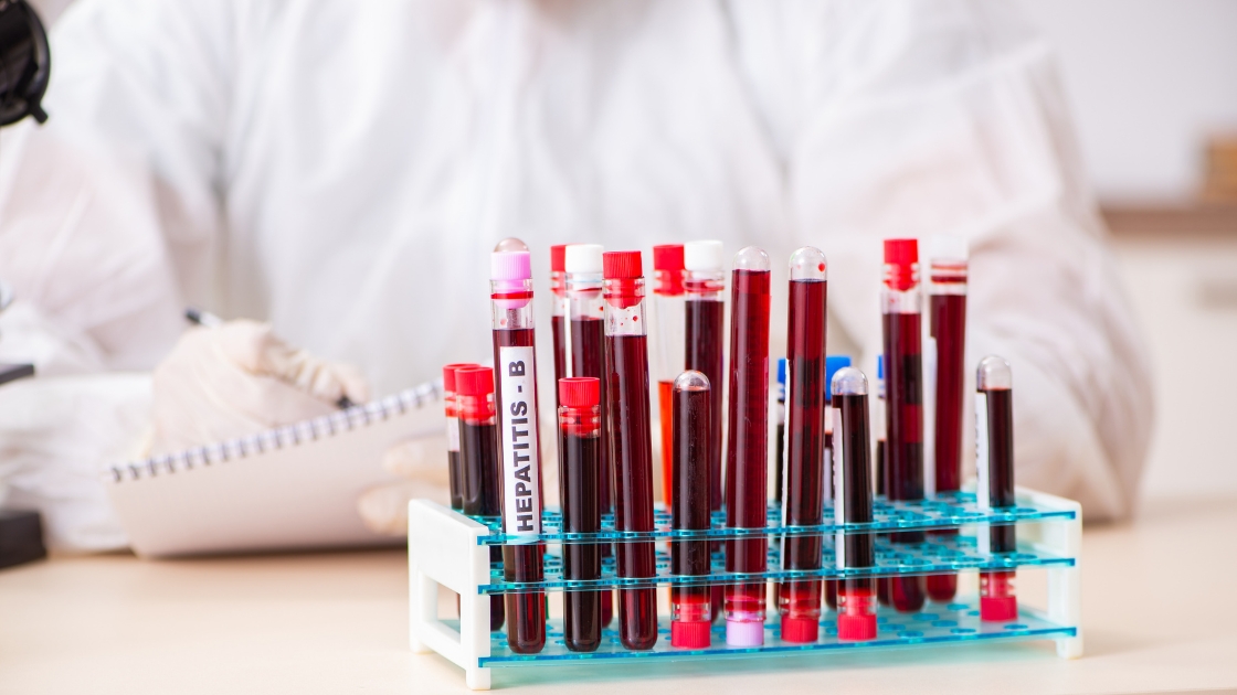 No momento, você está visualizando Hematologista: o que faz, quando procurar e como é a consulta com o Dr. Paulo Ganacini?